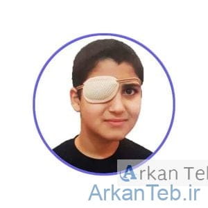 چشم بند تنبلی چشم پاکسمن
