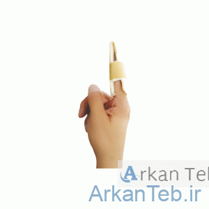 آتل انگشت چیپسو