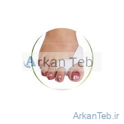 هالوکس والگوس دو انگشت دنباله دار ارکان طب