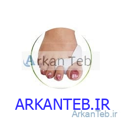 هالوکس والگوس دو انگشت دنباله دار ارکان طب