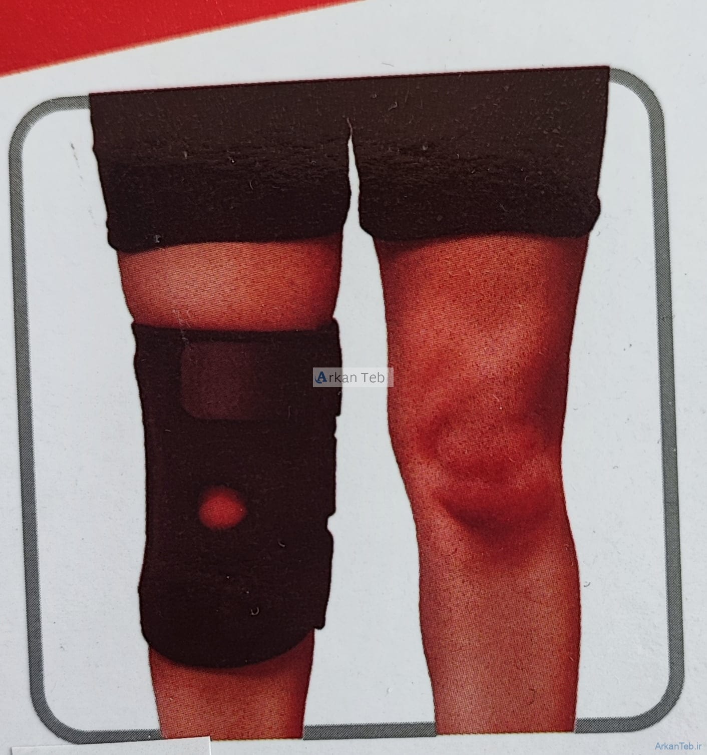 زانو بند آتل دار قابل تنظیم نئوپرن فری سایز برند مها طب آفاق ارکان طب