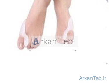 هالوکس والگوس تک انگشت ارکان طب