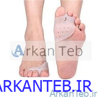 هالوکس والگوس سه انگشت دنباله دار ارکان طب