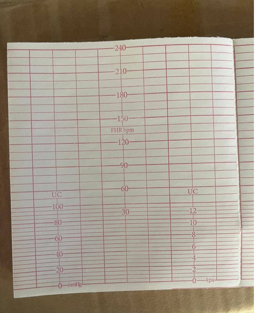 کاغذ فتال مانیتورینگ کامن نوع دوم ارکان طب