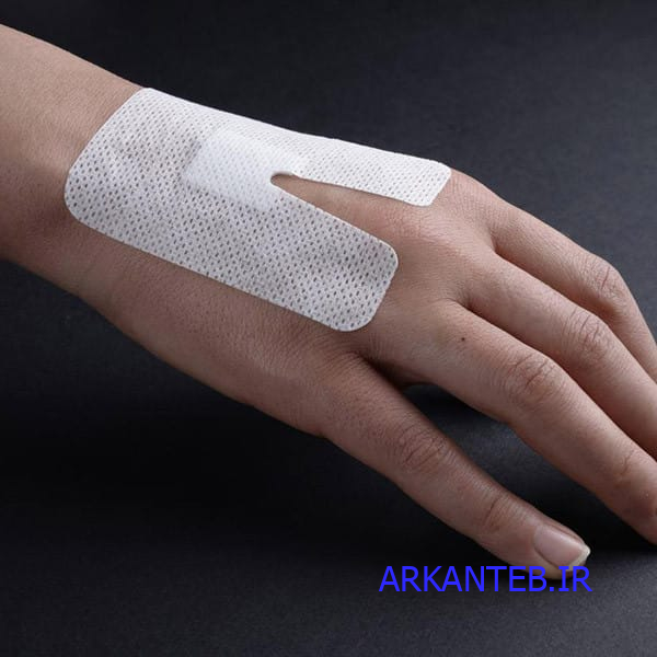 چسب آنژیوکت ارکان طب