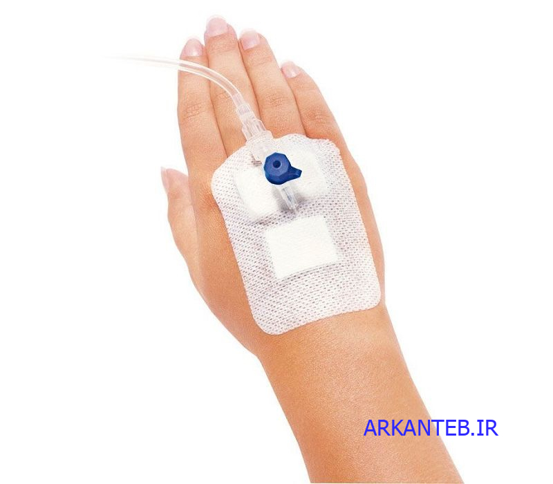 چسب آنژیوکت مدکو ارکان طب
